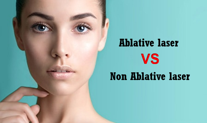 Mi a különbség az ablatív és nem ablatív lézernél?