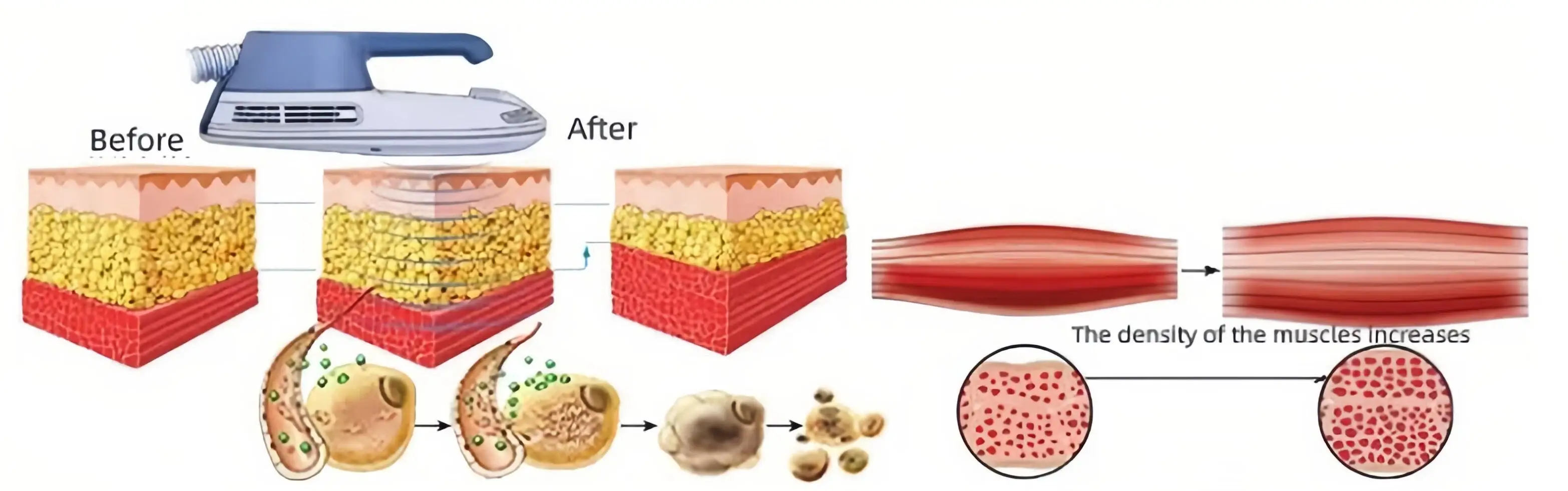 Ems Muscle Stimulation Rf Body Shaping Beauty Machine